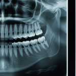 North America Dental X-Ray Market Growth, Opportunities, and Regional Forecast To 2027