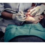 Things You Should Know Before Going Through The Root Canal Procedure
