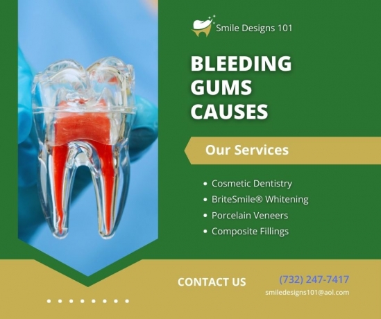 How Many Implants Do You Need for a Full Mouth of Teeth?