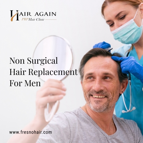 Understanding Laser Hair Replacement Therapy: A Comprehensive Guide to Regaining Your Confidence