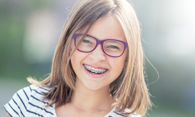 How Long Will You Need to Wear Braces? Understanding Your Treatment Plan