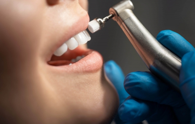 Keep Your Gums Healthy with Professional Cleanings