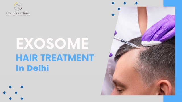 Exosome Hair Treatment – How is it Different From Other Procedures?