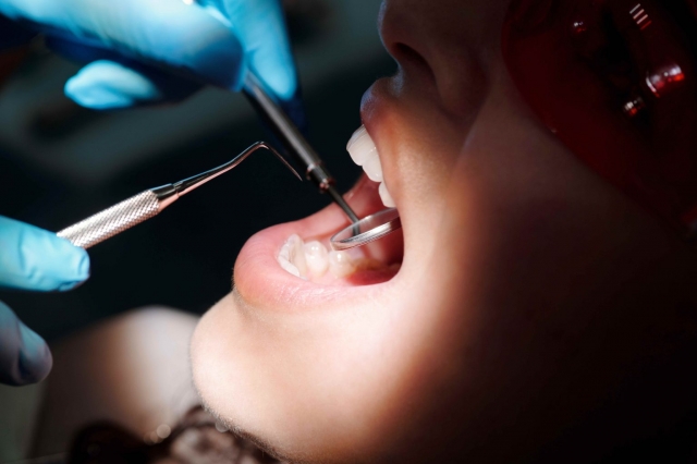Why Wisdom Tooth Extraction Might Be a Must?