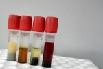 Using Human Serum Samples to Improve Diagnostic Accuracy