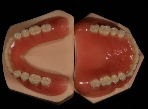 Acrylic Full Denture
