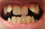 From Crowded to Confident, Orthodontic Solutions