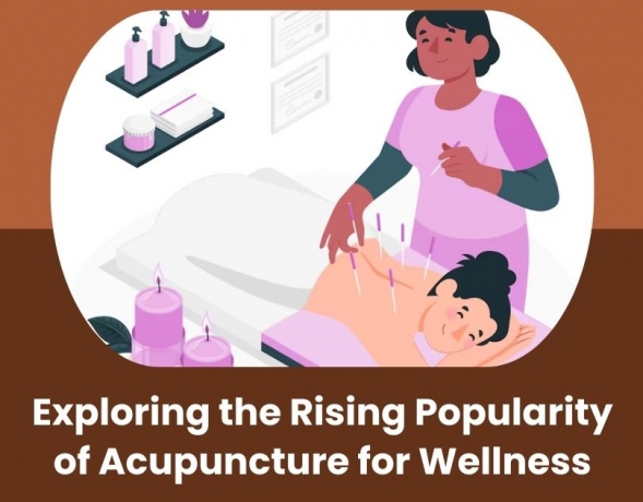Exploring the Rising Popularity of Acupuncture for Wellness