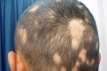 Is Your Hair Type Important to a Trichologist?