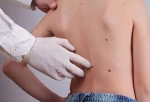 Are Natural Remedies for Skin Tags Safe in Dubai’s Environment