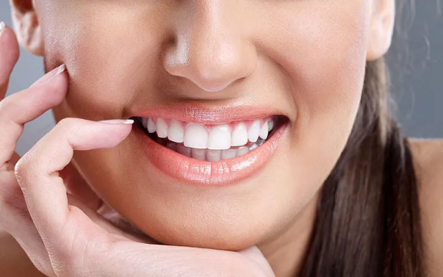 Are E-Max Veneers Prone to Cracking or Chipping in Dubai’s Climate