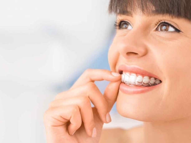 Training Your Dental Team for Invisalign Success