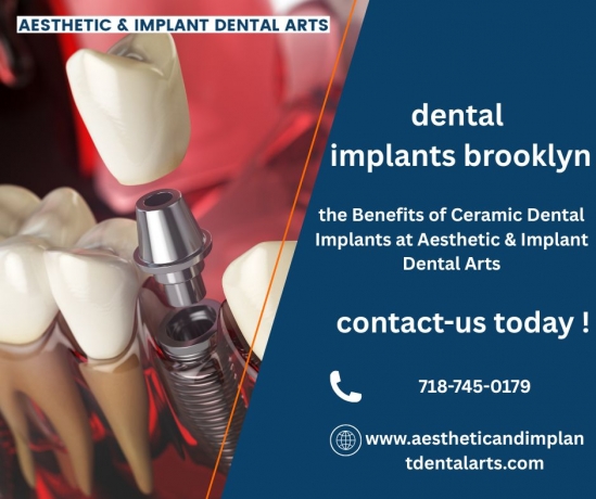 Will Insurance Pay for Dental Implants? 