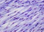 Human Osteoblasts Market Is Anticipated to Witness High Growth Owing to Advancements in Regenerative Medicine