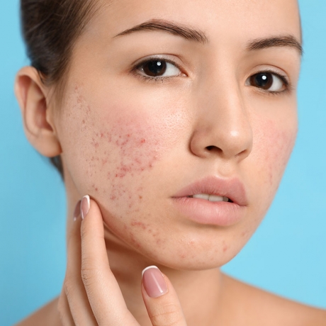 What Are the Top Causes of Skin Dryness in Dubai, and How Can I Prevent It