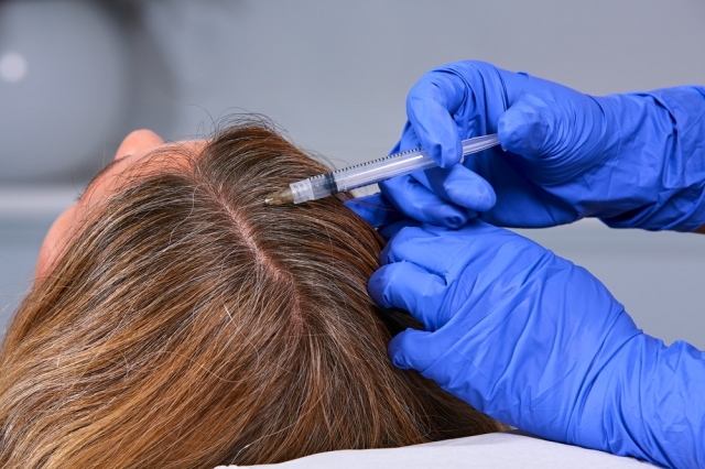 Fast and Effective Hair Loss Treatment for Gorgeous Hair