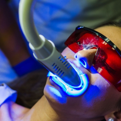 How Much Should You Really Pay for Teeth Whitening?