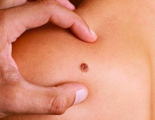 Berwick Skin Cancer Centre