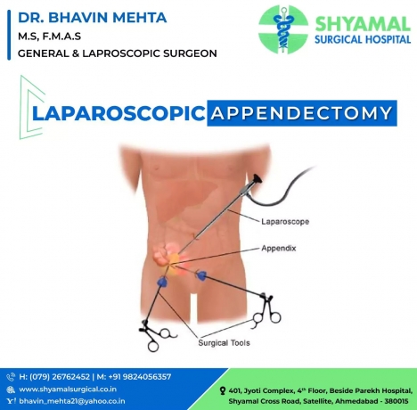 Best Laparoscopic Surgery in Satellite, Ahmedabad