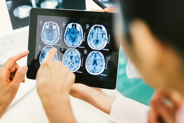 Chronic Traumatic Encephalopathy Market to Grow at Highest Pace Owing to Advancements in Diagnostic Technologies