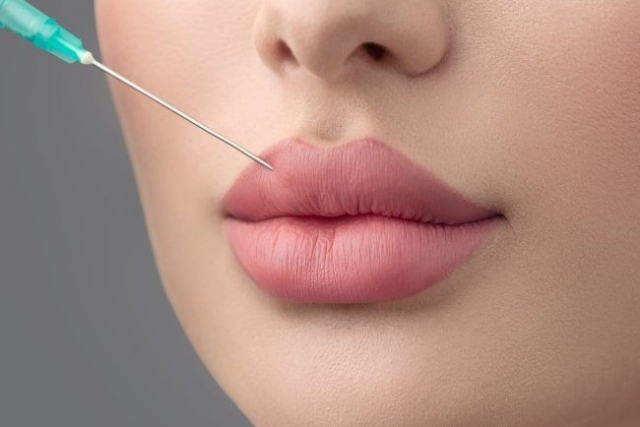 The Best Doctors in Dubai: Leading the Way in Russian Lip Fillers