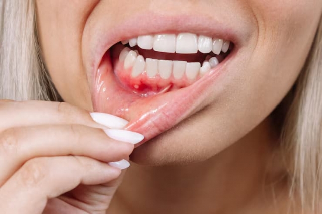 What a Gum Specialist Can Help You Treat
