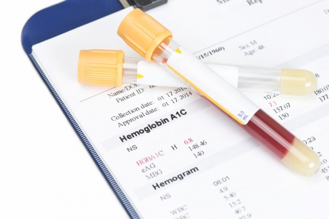 Glycated Haemoglobin Testing Market to Grow Rapidly with Personalized Diabetes Care 