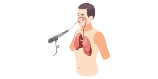 Find the Best Bronchoscopy Doctor in Varanasi for Accurate Lung Diagnosis