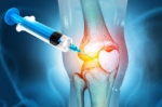 What Is the Recovery Process Like After Stem Cell Injections