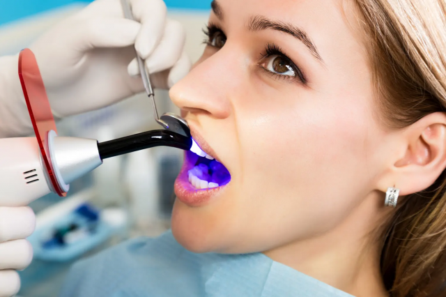 Composite Bonding on a Budget: Affordable Cosmetic Dentistry
