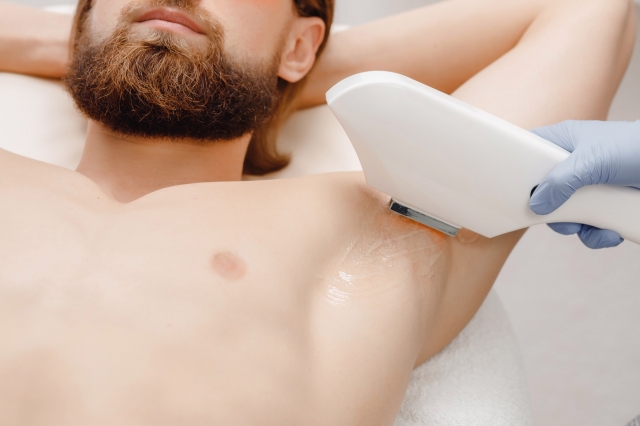 Save Time and Money with Laser Hair Removal for Men in Dubai