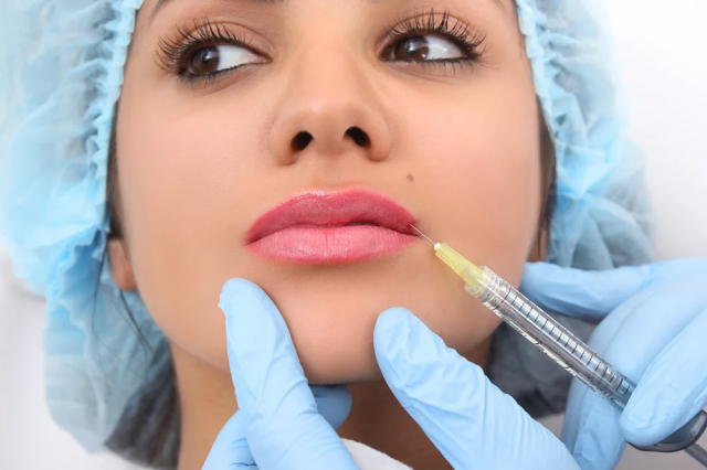 Does Lip Fillers Injections Improve Lip Contour?
