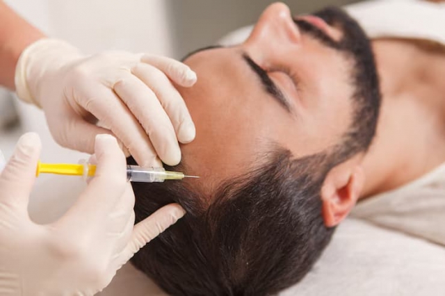 What to Expect During Mesotherapy Hair Treatment in Dubai