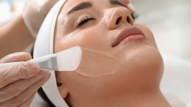 How Chemical Peels Target Sunspots on Face?