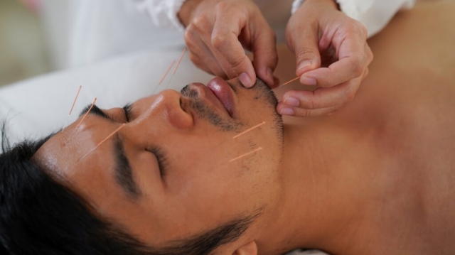 Experience Facial Acupuncture in Philadelphia Today