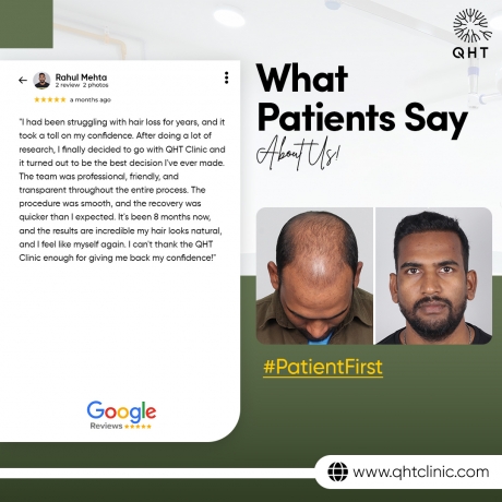 Leading Hair Transplant Solution for Men in India – QHT Clinic