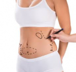 The Ultimate Guide to Liposuction in Dubai