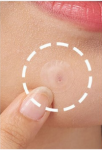 For Brands & Businesses: Partner With A Leading Hydrocolloid Patch Manufacturer