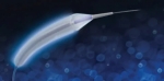 Drug Eluting Balloon Market Trends Driven by Rising Adoption