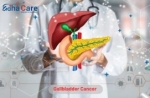 Advanced Gallbladder Cancer Treatment in India with EdhaCare