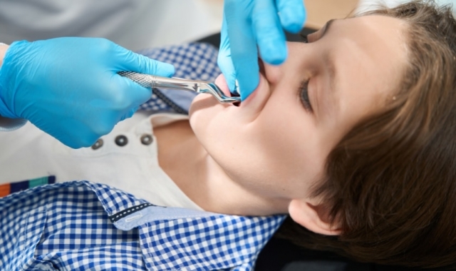 Tampa Tooth Extraction: Gentle, Reliable Treatment at Harmony Dental and Facial Aesthetics