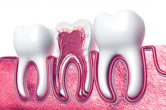 Insurance & Payment Plans for Root Canal in Islamabad