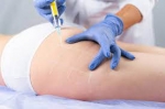 Body Contouring Made Easy with Fat Melting Injections in Dubai & Abu Dhabi