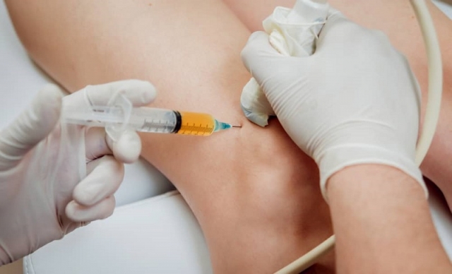 Dealing With Knee Pain? Here’s What You Need To Know Before Choosing A Doctor