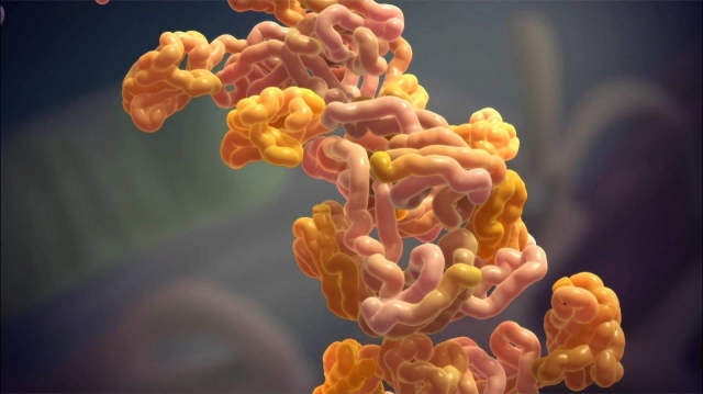 AL Amyloidosis Diagnostic Market Trends from Rising Prevalence