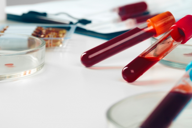 The Importance of Hormone Blood Tests in Managing Women's Health