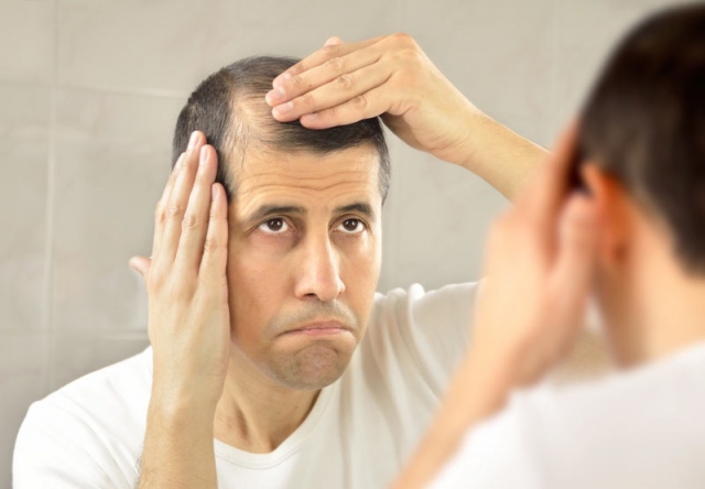 Alopecia and Hair Loss: Diagnosis, Care, and Advanced Treatment Options Available in Delhi