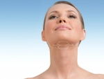 Double Chin Removal Options That Don’t Involve Downtime