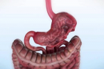 Is Gastric Plication a Good Fit for People With Moderate BMI?