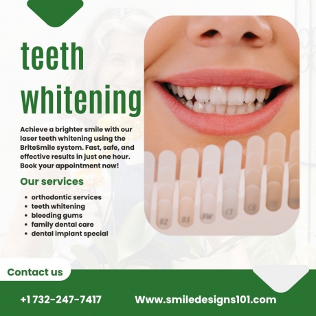 What Is the Best Dentist for Teeth Whitening in Somerset, NJ?